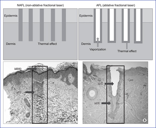 La microscop&iacute;a multifot&oacute;n