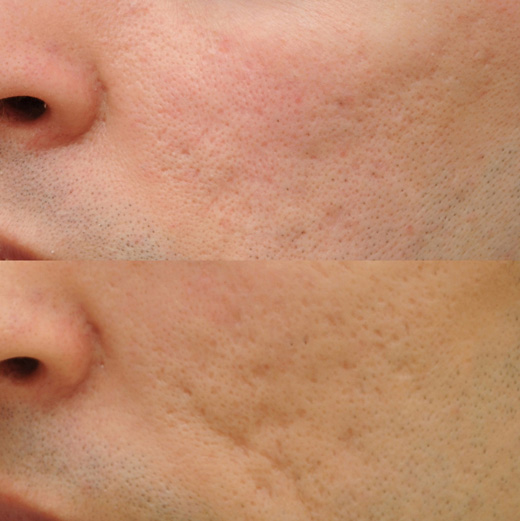 La microscop&iacute;a multifot&oacute;n