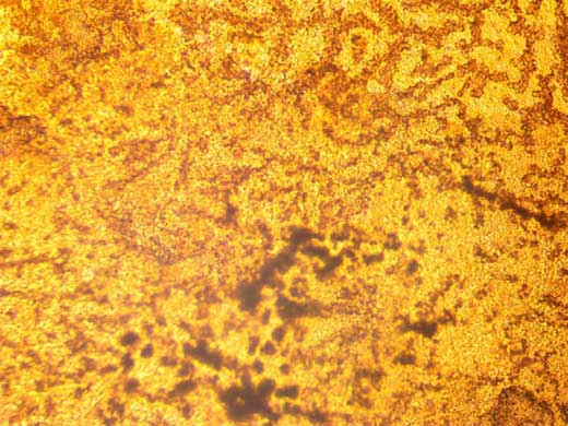 An&aacute;lisis Histologico