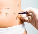 Nuevo mapa mundial de procedimientos est�ticos