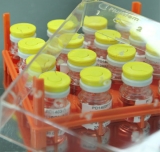 PLacental eXpanded (PLX): la nueva generaci�n en productos y terapias celulares