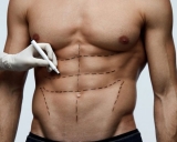 Daddy Do-Over y Baby Botox, dos de las tendencias est�ticas 2020